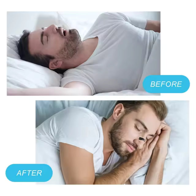 Dilatador Nasal Magnético